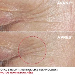 Clarins Soin Spécifique|Contour Des Yeux|- Total Eye Lift Rechargeable - Contour des yeux