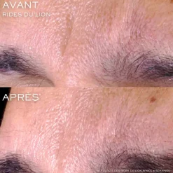 Lancôme Hydratant Visage|Sérum Visage|- Rénergie C.R.x. Triple Sérum Rétinol Sérum visage